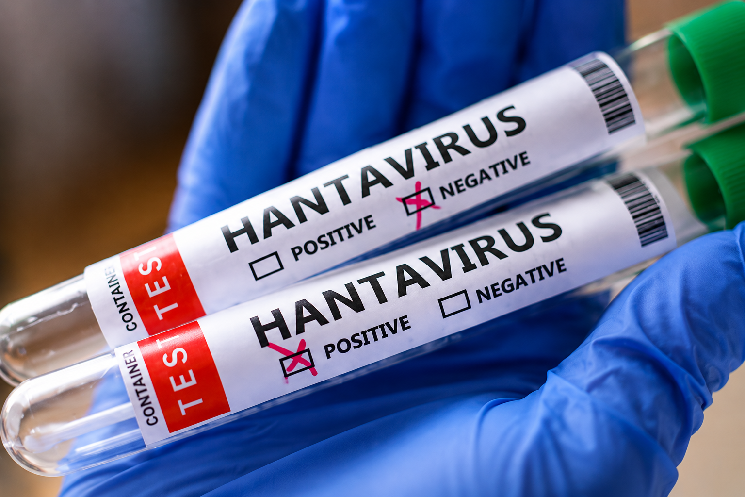 Global Hantavirus Outbreak on MV Hondius Prompts International Tracking Effort